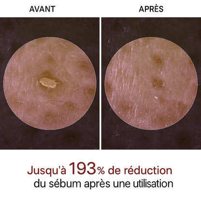 Peel Shot Coréen - Élimine les Impuretés et Sublime Votre Peau