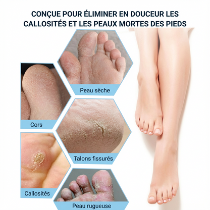 SmoothFeet™ - Râpe à pieds élimine les callosités des pieds