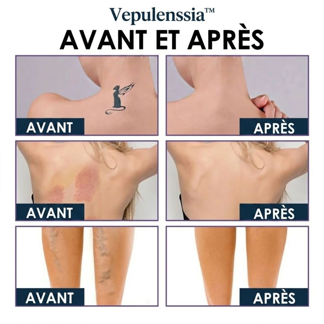 Crème Miracle Vepulenssia™ – Peau Lisse et Radieuse