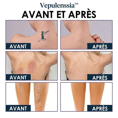 Crème Miracle Vepulenssia™ – Peau Lisse et Radieuse