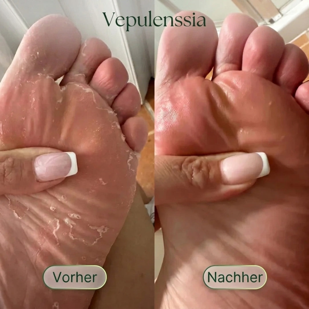 Antimykotische Reinigungsseife Vepulenssia