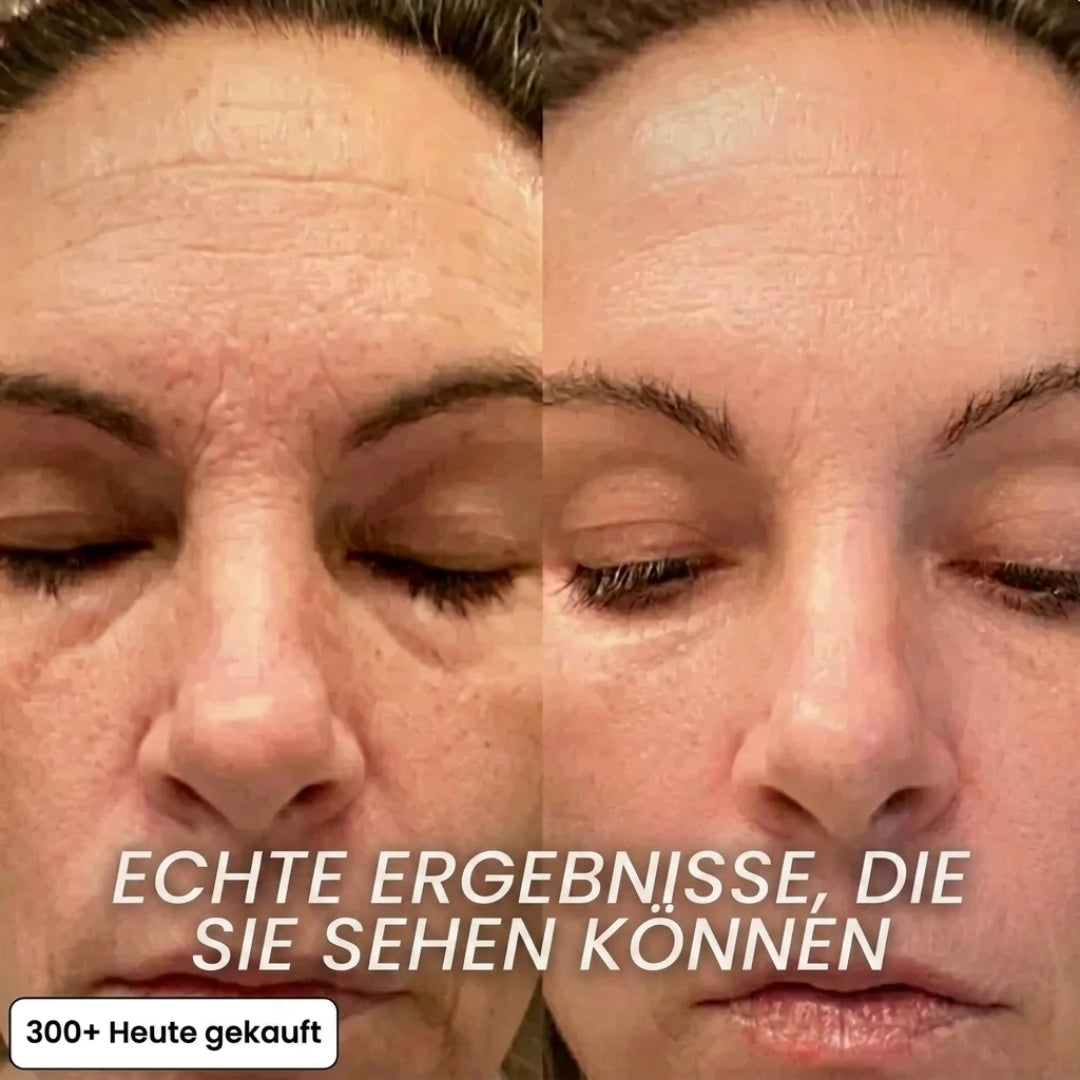 Vepulenssia Bio-Kollagen Aufpolsternder Stick