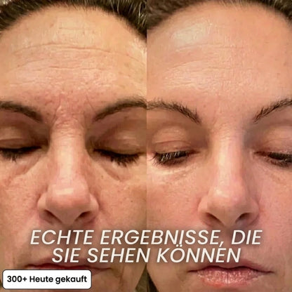 Vepulenssia Bio-Kollagen Aufpolsternder Stick
