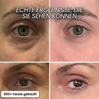Vepulenssia Bio-Kollagen Aufpolsternder Stick